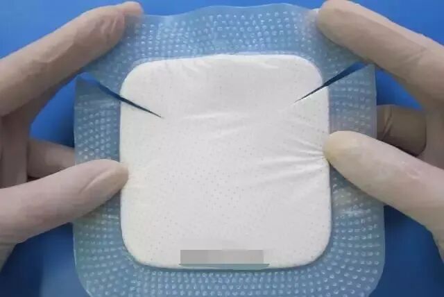 伤口贴敷料为什么护士，你贴的敷贴又卷边了？这里有八种敷贴固定技巧_https://www.jmylbn.com_新闻资讯_第6张