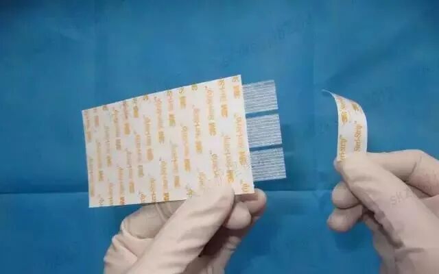 伤口贴敷料为什么护士，你贴的敷贴又卷边了？这里有八种敷贴固定技巧_https://www.jmylbn.com_新闻资讯_第20张