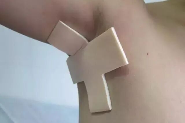 伤口贴敷料为什么护士，你贴的敷贴又卷边了？这里有八种敷贴固定技巧_https://www.jmylbn.com_新闻资讯_第5张