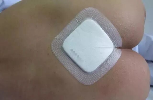 伤口贴敷料为什么护士，你贴的敷贴又卷边了？这里有八种敷贴固定技巧_https://www.jmylbn.com_新闻资讯_第17张