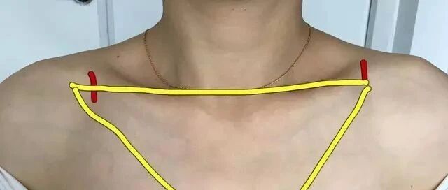 98%护士不知道，除了手腕，原来还能在这些部位做皮试！