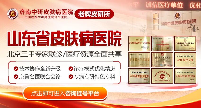 山东人必看！看皮肤挂号难？一键解锁便捷挂号通道！山东省皮肤病医院-山东皮肤病医院-山东皮肤病医院预约挂号