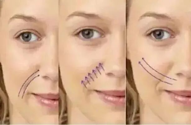 pga和pgla有什么区别早读 ｜ 线雕干货！5大角度深度讲解_https://www.jmylbn.com_新闻资讯_第7张