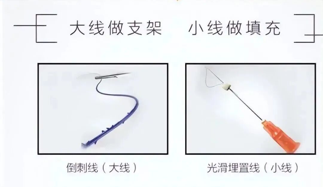 pga和pgla有什么区别早读 ｜ 线雕干货！5大角度深度讲解_https://www.jmylbn.com_新闻资讯_第2张