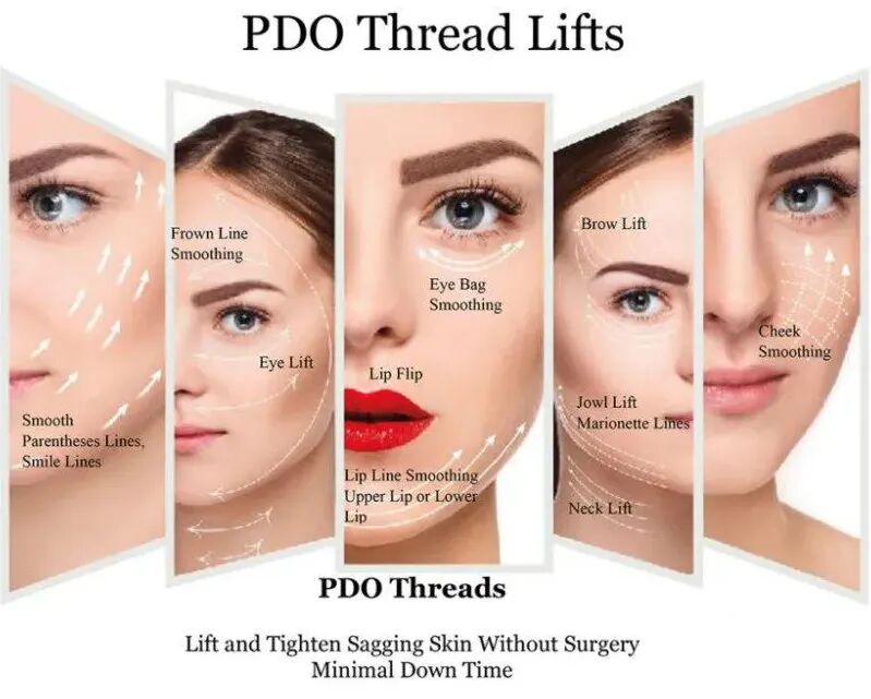 pga和pgla有什么区别早读 ｜ 线雕干货！5大角度深度讲解_https://www.jmylbn.com_新闻资讯_第5张