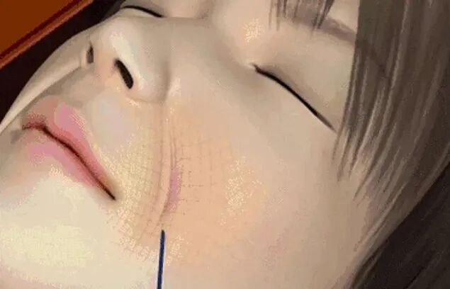 pga和pgla有什么区别早读 ｜ 线雕干货！5大角度深度讲解_https://www.jmylbn.com_新闻资讯_第4张