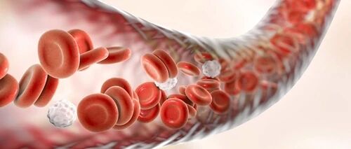 血管一堵，偏瘫、心梗易找上门！这些养护血管的窍门，早知道早受益！