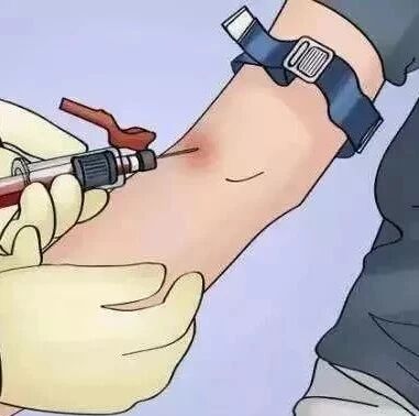 空腹抽血，到底怎样算“空腹”？指南明确了！