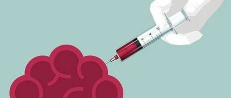 血小板减少症为何容易反复？常见这四点原因！