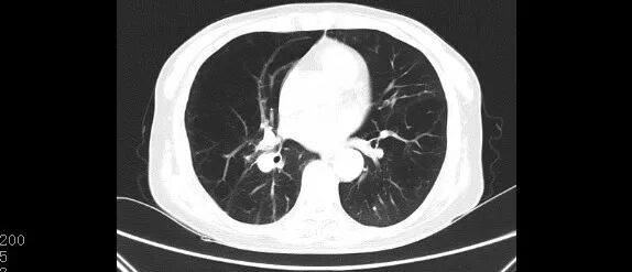 家用呼吸机怎么用家用无创呼吸机的使用_https://www.jmylbn.com_新闻资讯_第2张