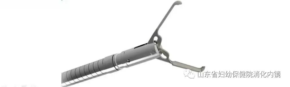 内镜夹怎么不掉医生切完息肉竟把“夹子”落在了肚子里？别慌！听听专家怎么说_https://www.jmylbn.com_新闻资讯_第5张