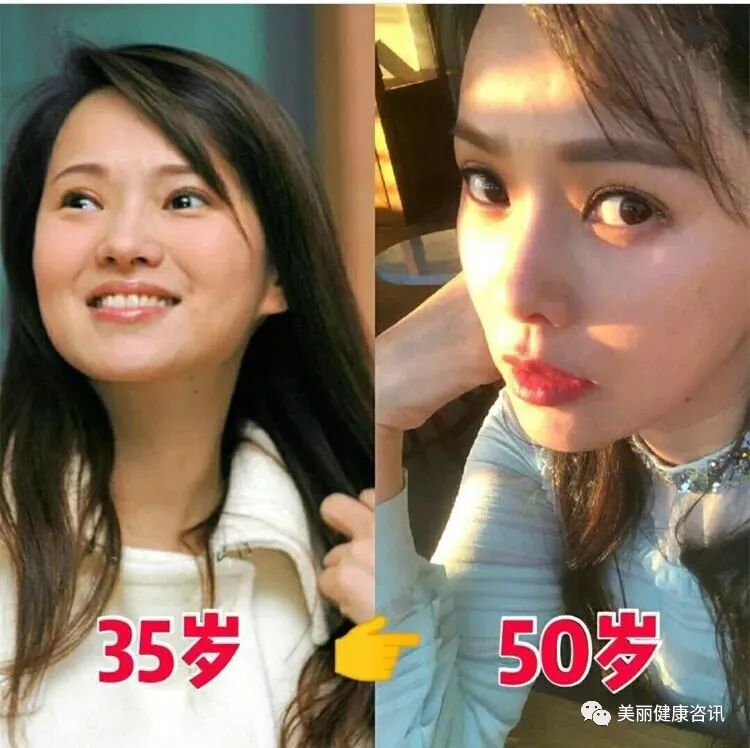 【SOMADERM凝胶】女人想抗衰，除了爱情还需要这个...