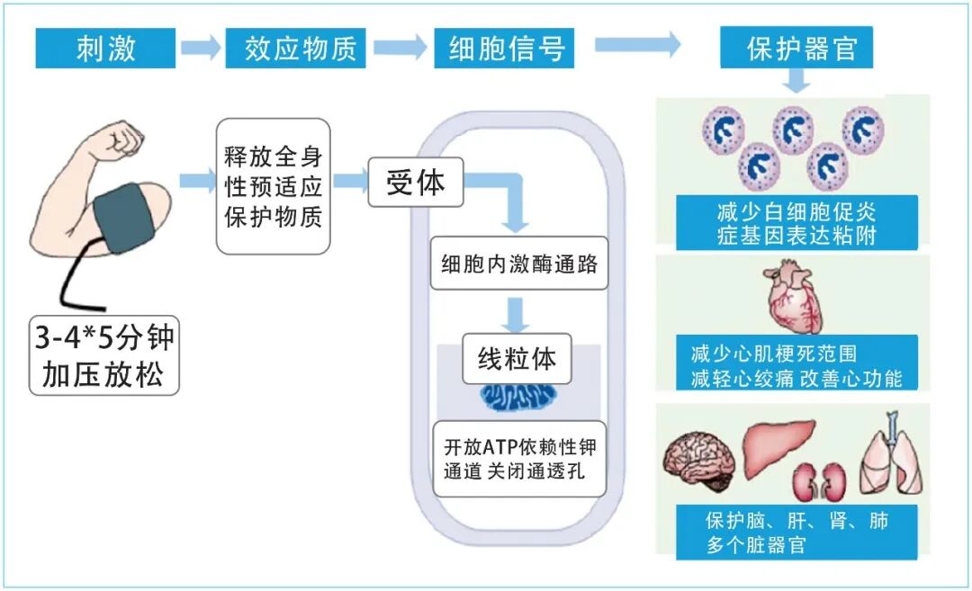 缺血适应训练仪怎么研究表明：缺血预适应训练不仅只对心脑血管疾病有效_https://www.jmylbn.com_新闻资讯_第4张