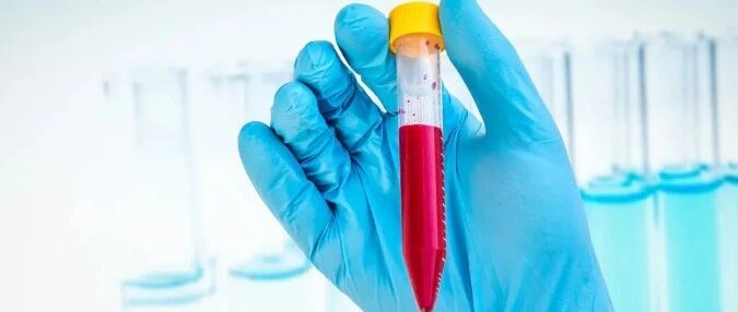 肾病最怕这个“隐性杀手”！早做好2点，别让肾功能再受损