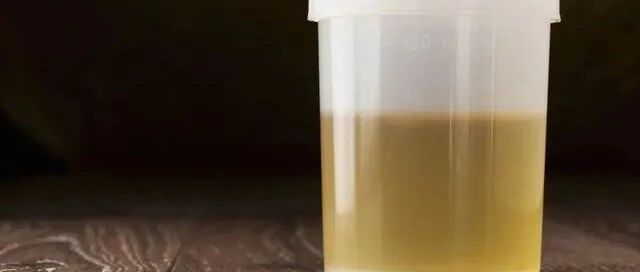 肾病尿蛋白降到多少，才不会肾衰竭？答案耐人寻味