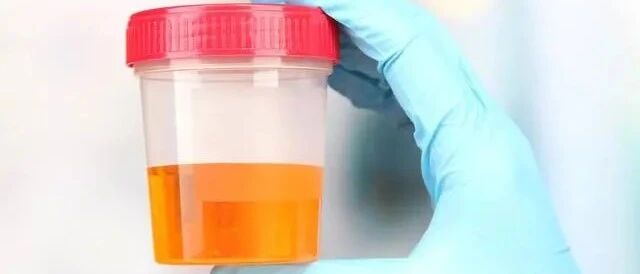 为什么激素能治蛋白尿，但却不能彻底治愈肾病？