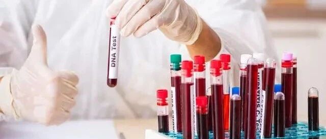 肾病最该了解的4大问题，早知道或许你不会尿毒症