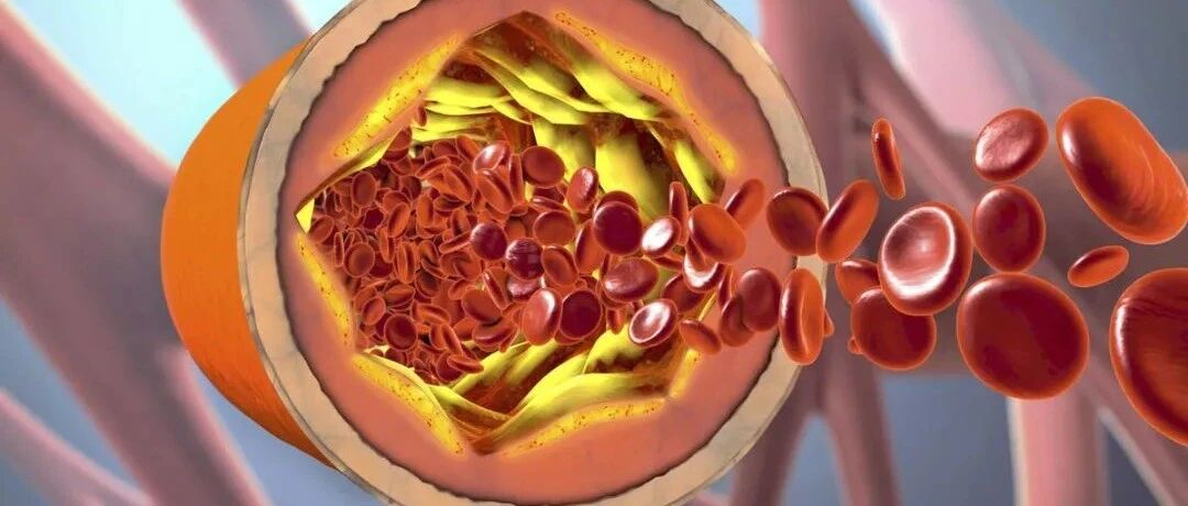 肾病处在4种情况很危险，提示肾衰竭在靠近