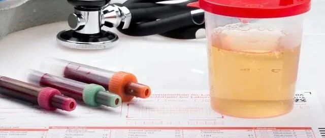 降蛋白尿注意避开4个误区，可有效降低肾衰竭