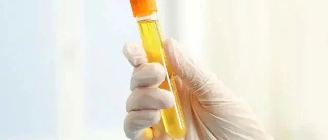 尿蛋白对肾脏的伤害多大？是尿毒症的“祸首”之一