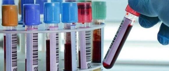 血肌酐高一点点，到底是不是肾衰竭？