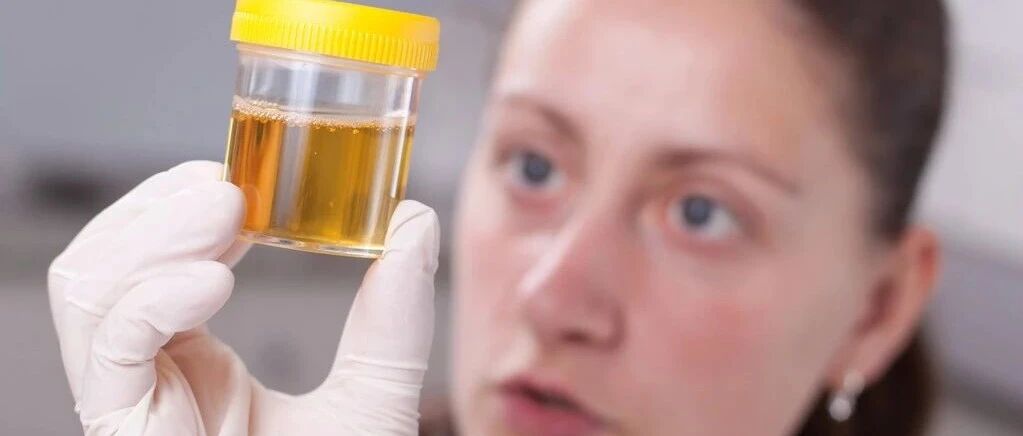 看尿量就知道肾功能的好坏！防范尿毒症，注意这2点