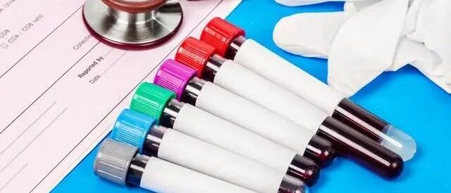 3种方法可以降肌酐！但要延缓肾功能，还需注意2个关键点