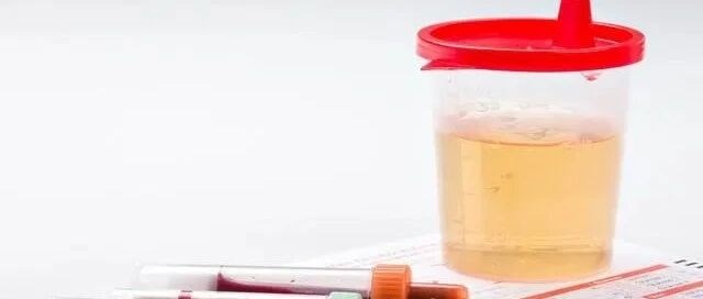 肾病初期是否会发展到肾衰竭，关键在于三方面