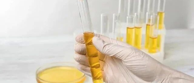 注意2件事，也能显著降低蛋白！