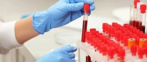 ​降肌酐没有特效药，如何避开尿毒症？4种方法值得一试