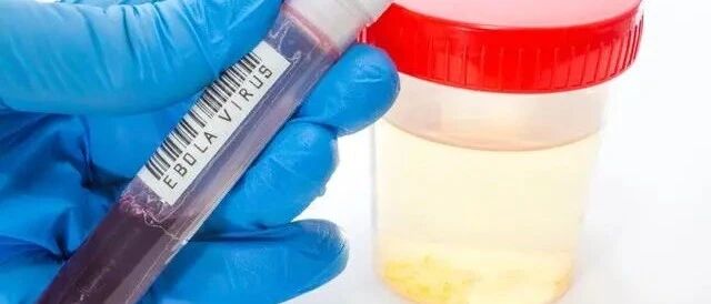 预防尿毒症，别只盯着肌酐、蛋白尿，还有6点不可或缺