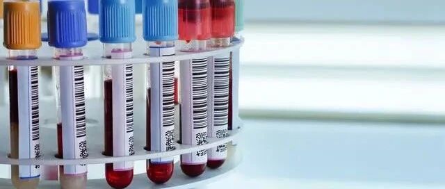 降肌酐是选择西药还是中药？肾内医生道出了2点真相