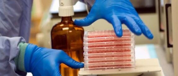 这3个肾病指标，重要程度不亚于尿蛋白和血肌酐