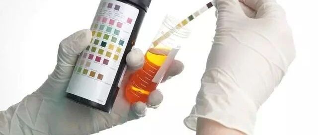 有效降尿蛋白，激素“单枪匹马”可不行 还要记住3点