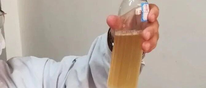 尿蛋白越高越好治？是真相还是谣言？