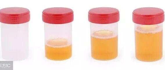 降蛋白最好的方法是什么？就是这3步，照做的，几乎都转阴了