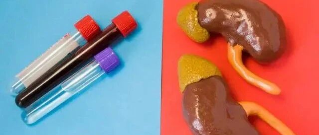 导致肌酐升高的三个常见原因，不可忽视