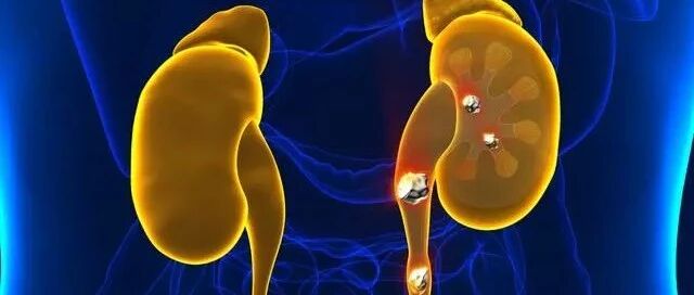 3个肾病误区会拖累你的肾，不想肾衰竭，肾友注意避开