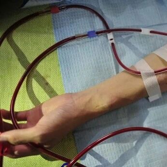 防范尿毒症的2点关键方法，很多人却忽视了