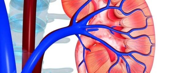 ​导致肾衰竭高发的原因中，排在前5名的是它们！需趁早铲除