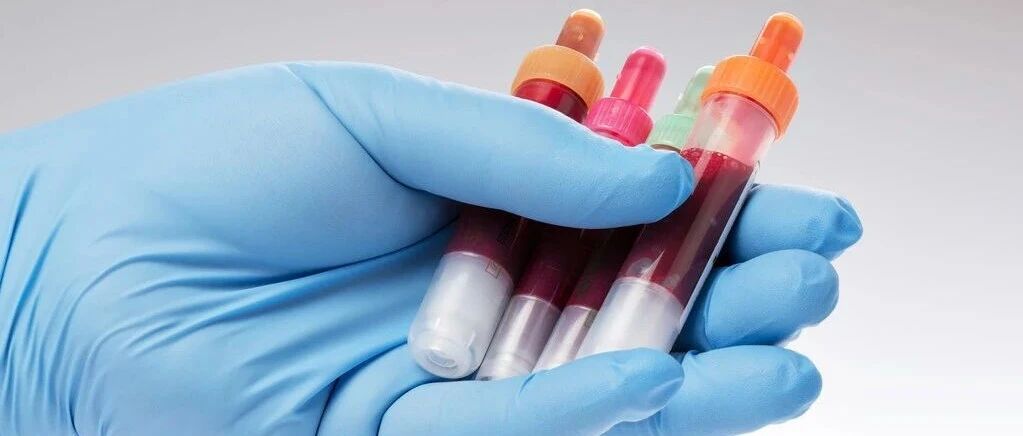 尿蛋白降了，但肌酐还是很高？提醒：防肾衰竭关键在一点