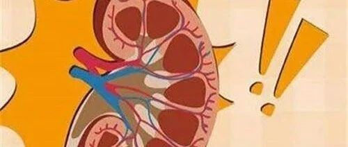 病理科普：你是否知道膜性肾病该怎么治？