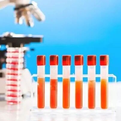 ​血肌酐高了别慌，这4件事比降肌酐更重要！