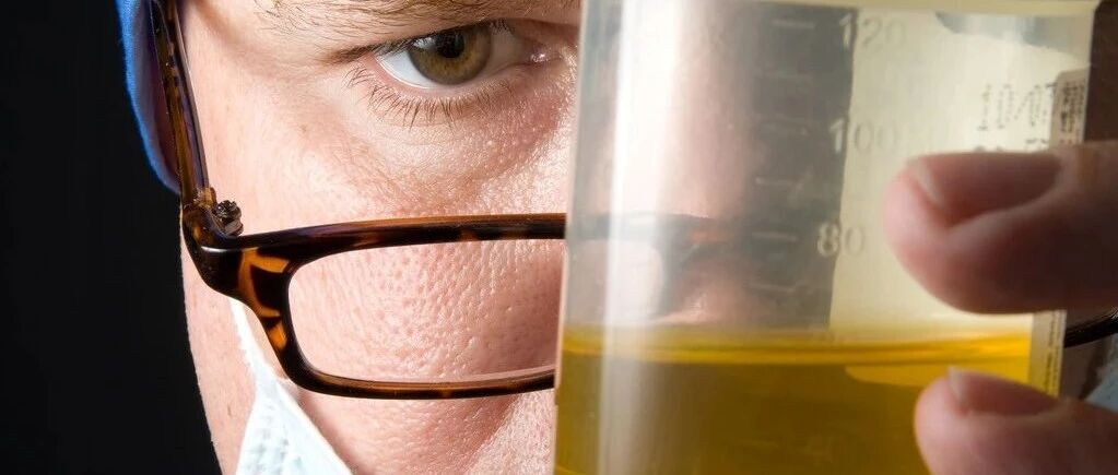 尿蛋白稳定的肾友都离不开4项措施！做到2个也能维持肾功能稳定