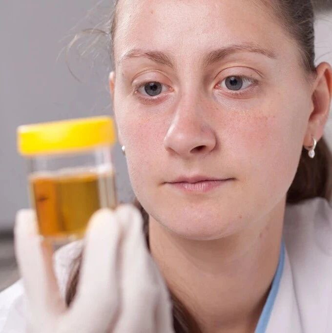 尿蛋白总反复，又不想做肾穿刺怎么办？有2种解决方法