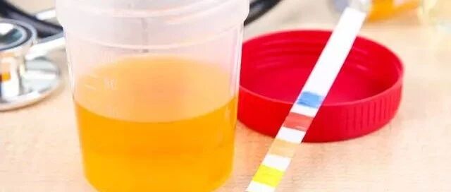 蛋白尿高会增加肾衰风险？降蛋白护肾注意这两点