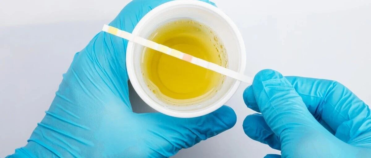 肾病反复性蛋白尿，如何用药？3类药物“组合”较为强劲