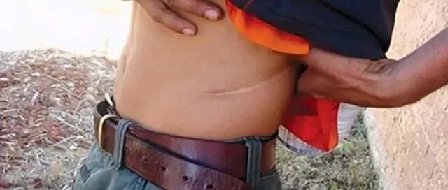 ​肌酐高别怕！处于这个范围，完全有可能恢复正常