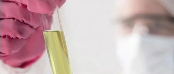 尿蛋白降下来后，以免反复，否则病情会反弹