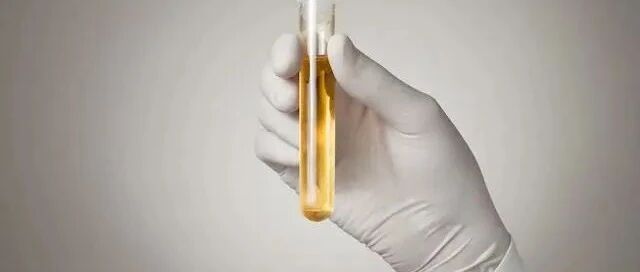 肾病防尿毒症，有3项更重要的指标要密切关注